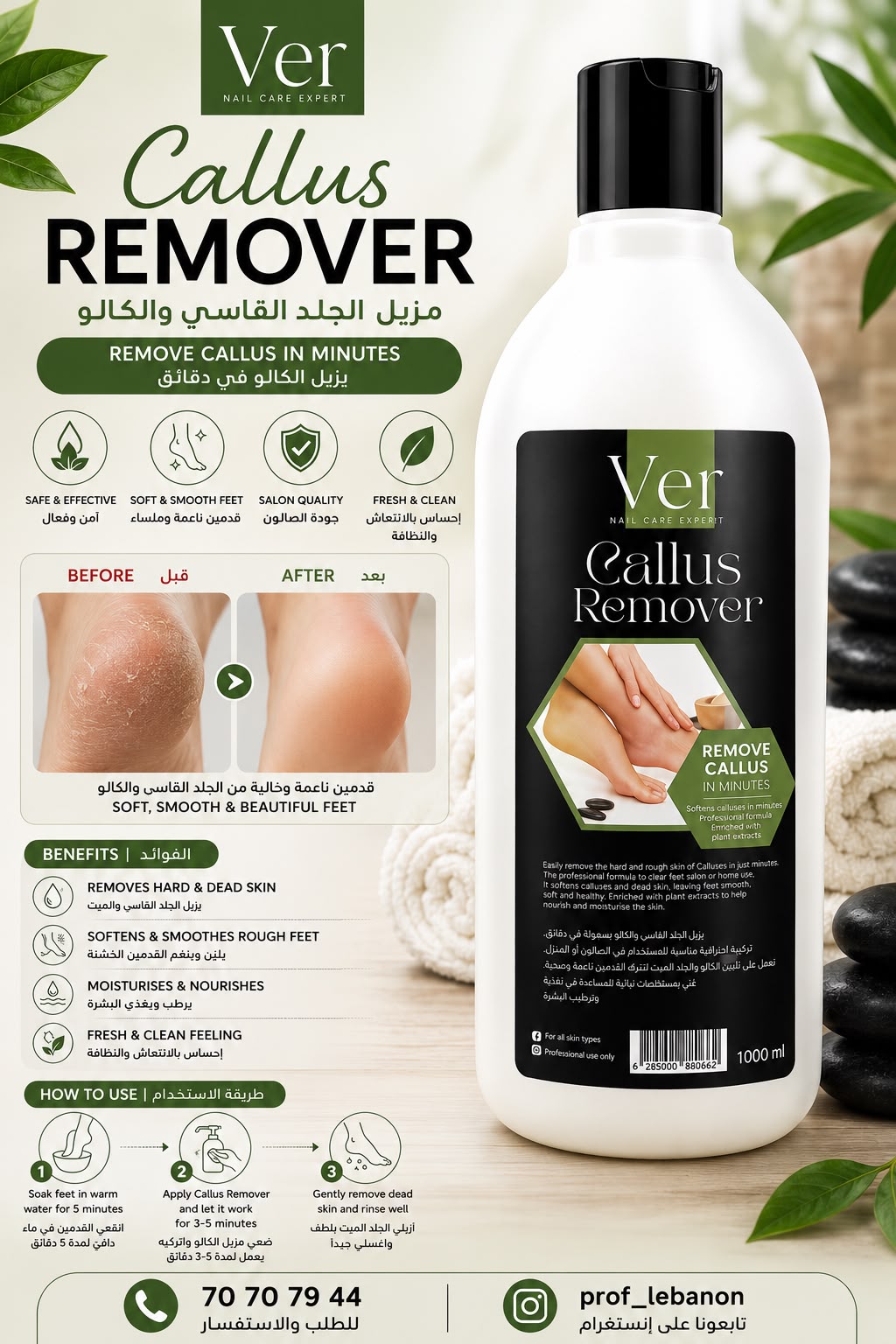 Ver Professional Callus Remover – 1000ml