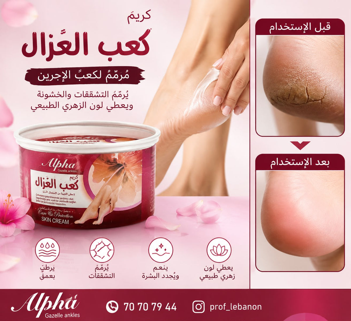 Alpha Gazelle Ankles Heel Repair Cream